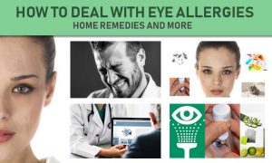 HOW TO DEAL WITH EYE ALLERGIES: HOME REMEDIES AND MORE