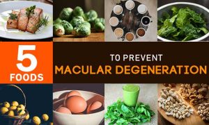 5 FOODS TO PREVENT MACULAR DEGENERATION