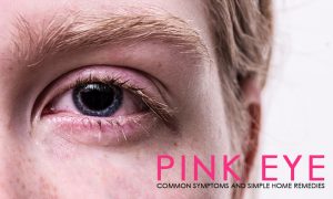 Pink Eye common symptoms home remedies
