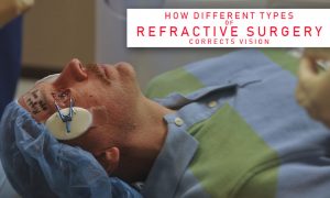 HOW DIFFERENT TYPES OF REFRACTIVE SURGERY CORRECTS VISION