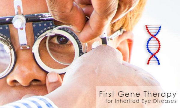 First Gene Therapy For Inherited Eye Diseases