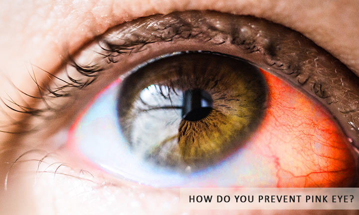 How-do-you-prevent-pink-eye